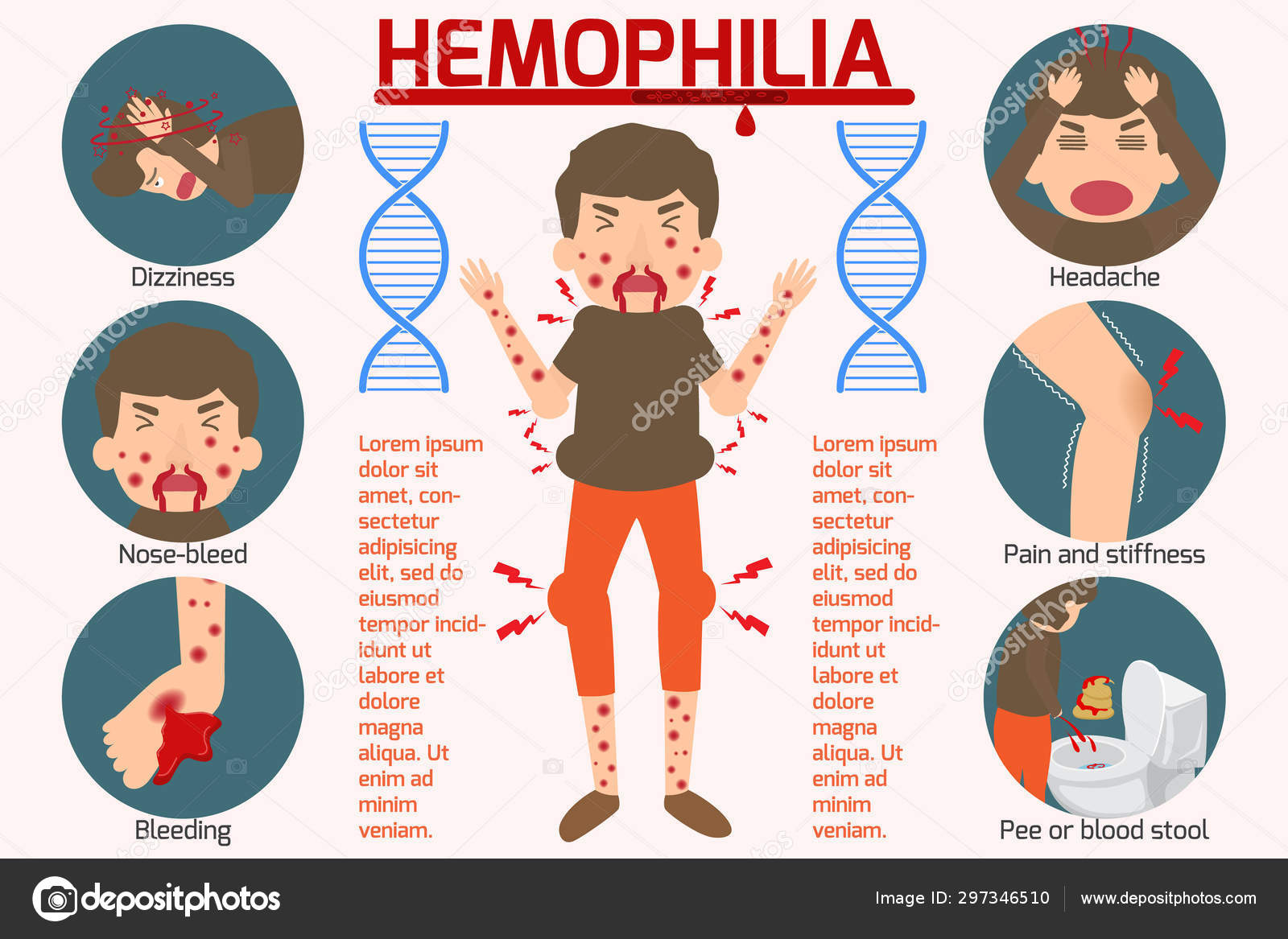 Hemofilia Jest Chorobą Recesywną Sprzężoną Z Płcią Hemophilia symptom Infographics elements. Sign and Symbols of He