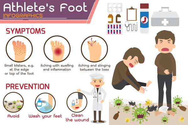 Athletes foot or Hong kong foot Disease Infographics. — Stock Vector