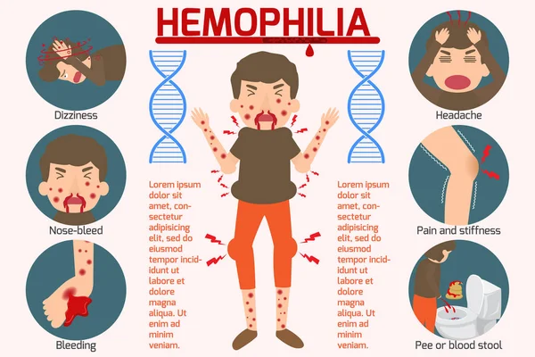 Hemophilia symptom Infographics elements. Sign and Symbols of He — Stock Vector