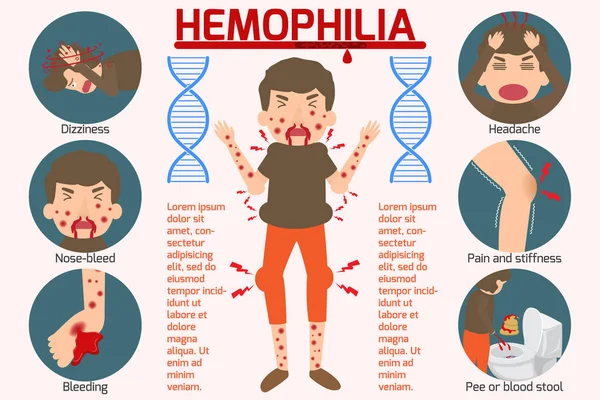 Sintoma hemofilia Elementos infográficos. Sinal e Símbolos d 'Ele —  Vetores de Stock