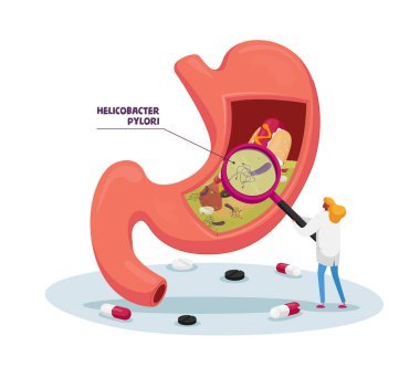 Helicobacter Pylori hastalığı ya da mide iltihabı olan Büyüteç Hastalığı Öğrenen Küçük Doktor Karakteri. Gastroenteroloji Tıp ve Sağlık Konsepti. Çizgi film Vektör İllüstrasyonu