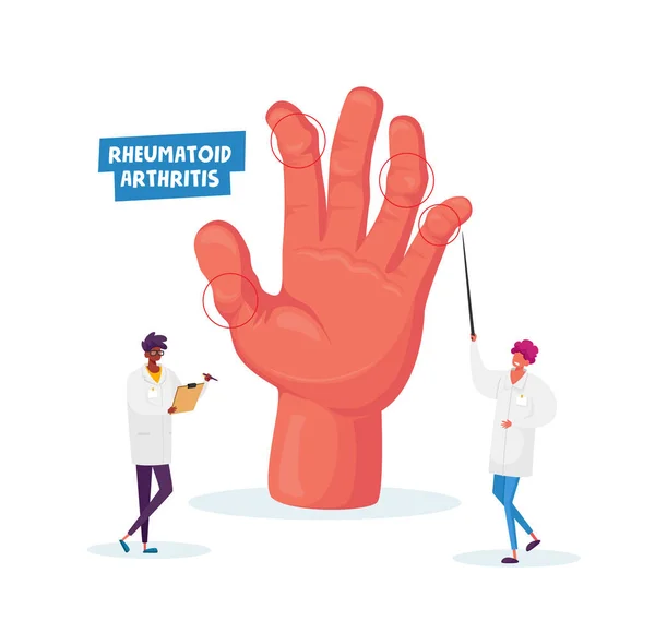 Ревматоидный артрит. Врач-артролог указывает на огромную руку с болезнью суставов, медсестра с доской клипа, соколиум — стоковый вектор