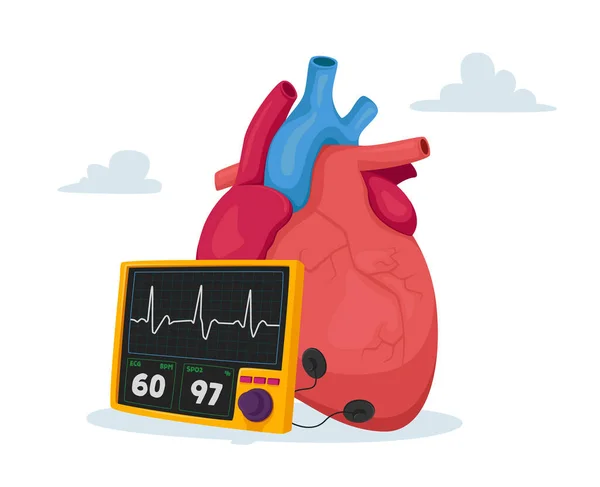 Alta pressione sanguigna del colesterolo e aterosclerosi. Cuore umano con impulso dello spettacolo del pannello digitale. Medicina Cardiologica — Vettoriale Stock