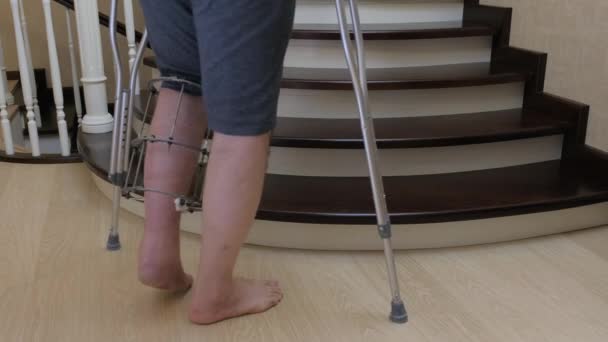 在伊利扎罗夫的外置固定器上用拐杖用拐杖爬楼梯 腿断了 — 图库视频影像