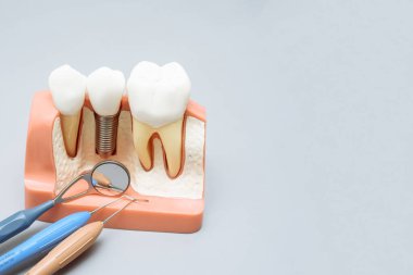 Diş aynasının yanında yapay dişler ve takma dişler. Gri arka planda sondalar..