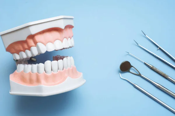Strumenti Dentisti Mascella Artificiale Sfondo Blu Concetto Cura Dentale Andare — Foto Stock