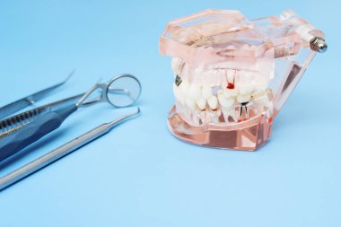 Mavi arka planda dişçi aletleri ve yapay çene. Diş bakımı ve diş hekimliği konsepti