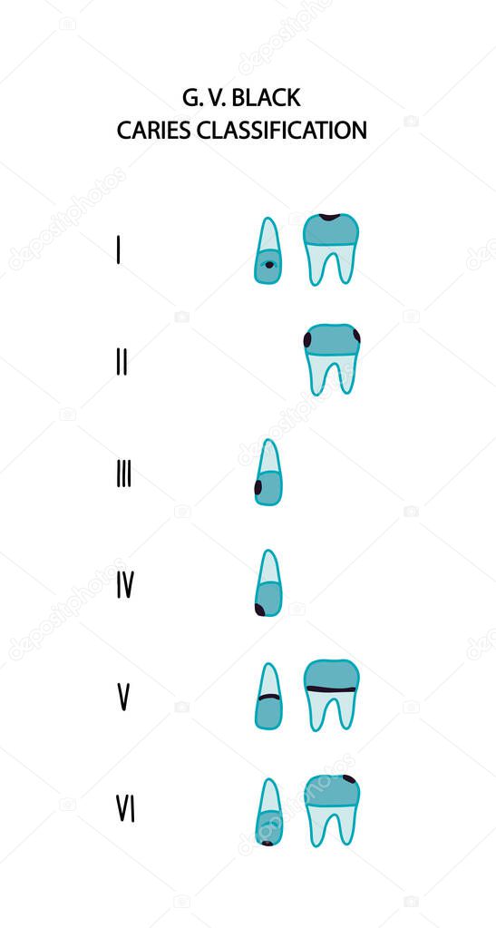 Caries type classification black six hand drawn vector illustration in cartoon comic style