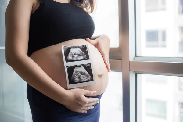 Mujeres embarazadas sostienen gran vientre de pie en la habitación cerca de la cortina — Foto de Stock