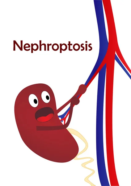 böbrek hastalığı nephroptosis, bir çizgi film böbrek, beyaz arka plan üzerinde dikey vektör çizim izole