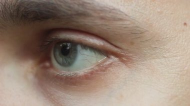 yanıp sönen erkek gözü yakın. pensive üzgün bakmak ilerive çerçeve makro içine. Bulanık arka planda bir adamın yarısı yüzü, ön görüş. göz küresi üzerinde kırmızı arterler. copyspace.