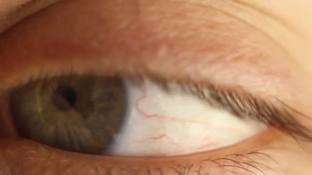 Cligner des yeux de mâle en gros plan regardant autour. artère rouge sur la macro du globe oculaire. réaction de la pupille à la lumière. Mioz et Midriaz. fermeture et ouverture de la paupière — Video