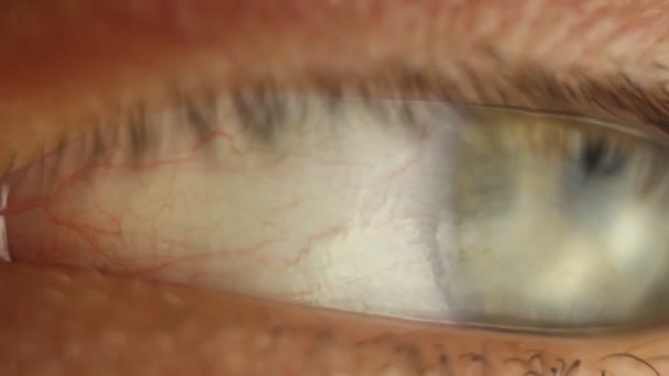 Моргающий мужской глаз крупным планом оглядывается вокруг. красная артерия на глазном макросе. реакция зрачков на свет. Миоз и Мидриаз. закрытие и открытие век — стоковое видео