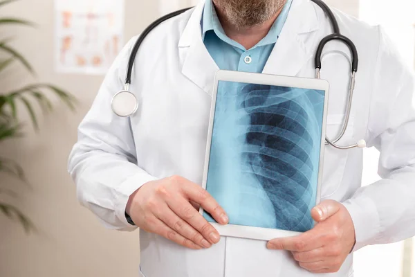 Bir tablet üzerinde dijital x-ray görüntü gösteren erkek doktor — Stok fotoğraf