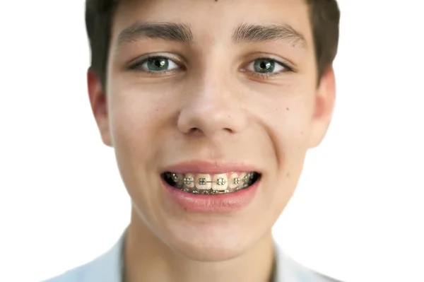 Teen Úsměvem Ukazuje Rovnátka Horní Dolní Zuby Izolovaný Zaměřit Složené — Stock fotografie