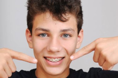 Gri arka planda güzel bir genç. İki elini de dişlerindeki diş tellerine koyar ve gülümser. Diş hekimi ve ortodontist konsepti