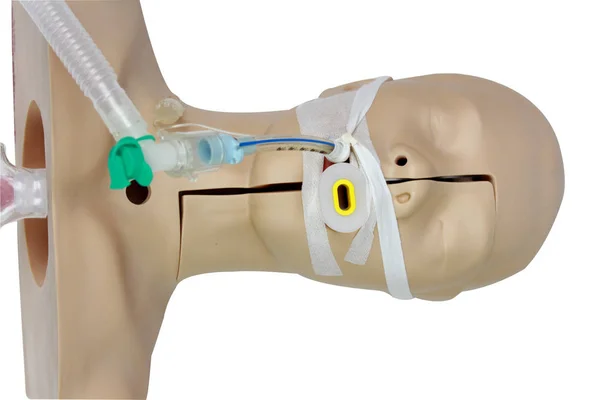 Yardımcı ventilasyon için endotrakeal hava yolu tüpü takılması, trakea ve özofagus arasındaki ilişkiyi tüp ile yerinde gösteren beyaz bir arka plan