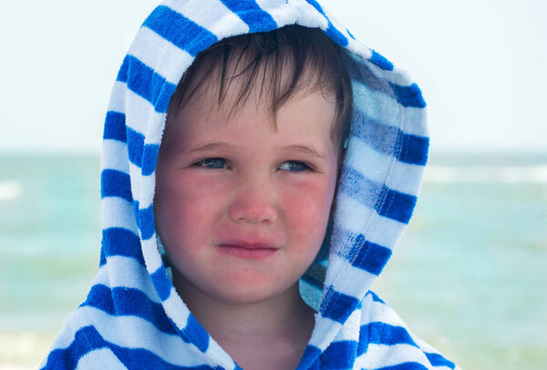 Small child with redness on the skin, suffering from food allergies