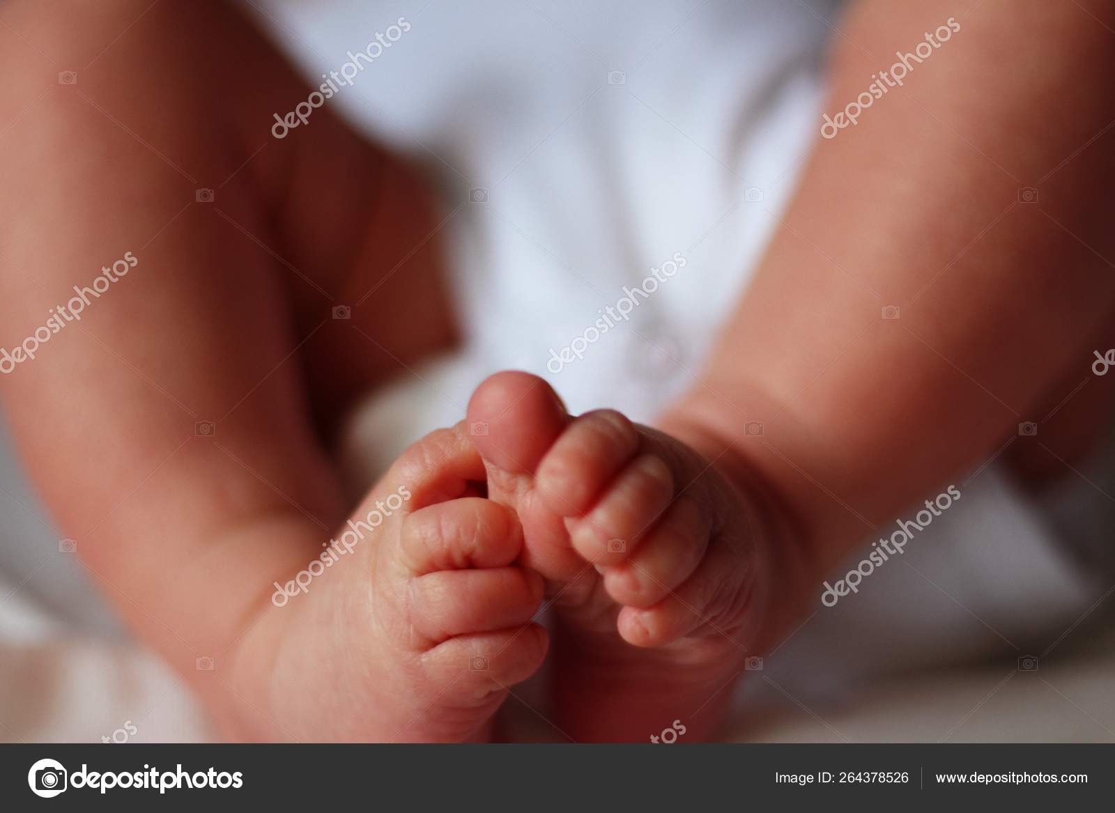 Clubfoot Stock Photos Royalty Free Images Depositphotos