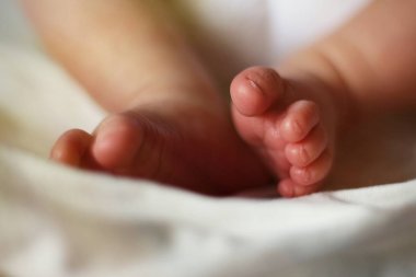 çorap clubfoot kalça displazisi olmadan yeni doğmuş bir erkek bebek ayakları