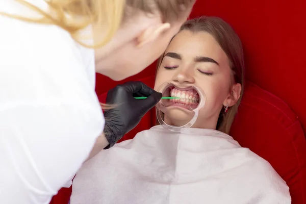 Sbiancamento Dei Denti Procedura Ragazza Ricezione Dentista Sbiancamento Dei Denti — Foto Stock