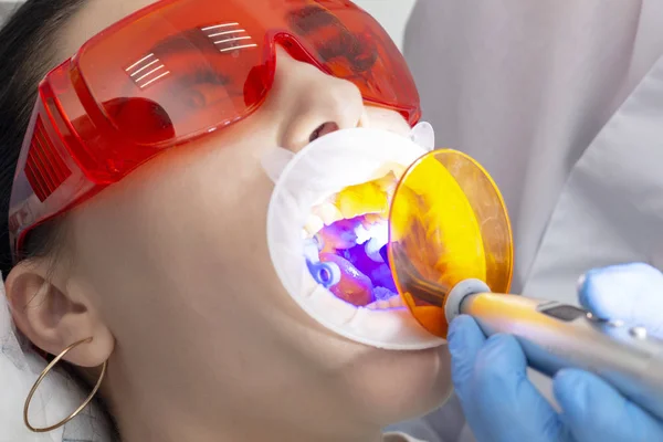 Ragazza Sulla Ricezione Preventiva Dal Dentista Medico Polimerizza Materiale Riempimento — Foto Stock