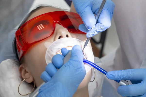 Una Ragazza Visita Dal Dentista Trattamento Della Carie Medico Utilizza — Foto Stock