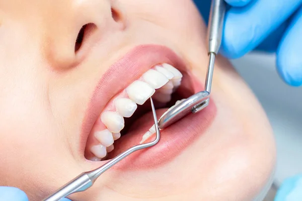Dentista Examina Dentes Dos Pacientes Dentista Perto — Fotografia de Stock