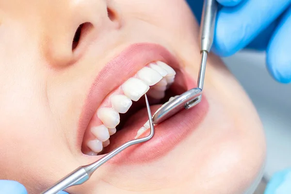 Dentista Esamina Denti Dei Pazienti Dal Dentista Vicino — Foto Stock