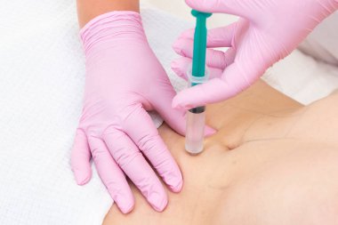 Lipolytic enjeksiyonlar mideye yerleştirilir. Pembe eldivenli kadın elleri karnına genç bir kadın enjekte ediyor..