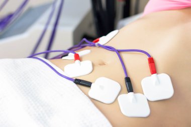 Karnına miostimülasyon elektrotları yerleştiriliyor. Güzel bir kadın figürü için anti-selülit masajı myostimülasyonu.