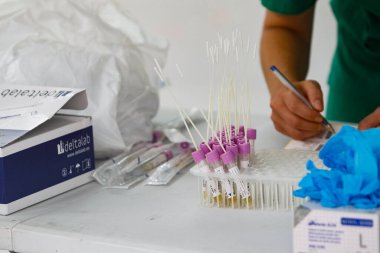 Bir Coruna-İspanya -18 Ağustos 2020: Bir sağlık çalışanı, Covid-19 'un varlığına veya yokluğuna karar vermek için bir arabanın içindeki bir kişi üzerinde PCR testi (ağız ve burun temizleyicisi) kullanır.