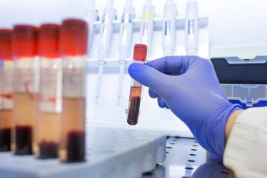 Biyolojistin elinde kan örneğiyle eritrosit kalıntısı olan bir tüp var.