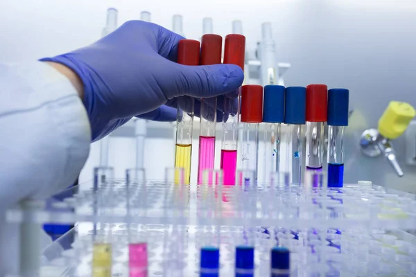 実験室で化学物質と保護手袋保持試験管の生物学者の手の閉じる — ストック写真