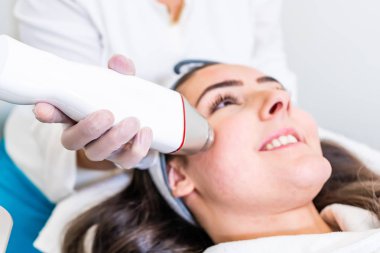 Bir güzellik cilt sıkma tedavisi sırasında bir kadının yüzünün yanak üzerinde radyo frekansı microneedling makine el parçası.