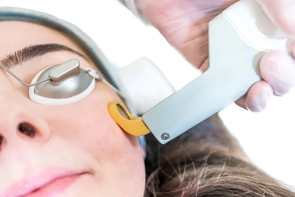 Close up of a 532 and 1064 nm wavelength and Nd:YAG laser being used as a skin treatment on female patient, in a beauty clinic. Shows hand piece with circular ring to direct laser on skin. — Stock Photo, Image