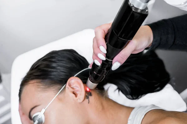 Laser tattoo removal treatment session on patient, using picosecond technology, to break down tattoo ink into smaller particles. At a beauty and skincare clinic for aesthetic lasers.