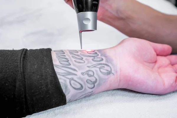 Rimozione del tatuaggio laser di un grande tatuaggio sul braccio di un paziente, utilizzando la tecnologia laser picosecondo, in una clinica laser di bellezza e medica. Il tecnico sta tenendo il manipolo . — Foto Stock