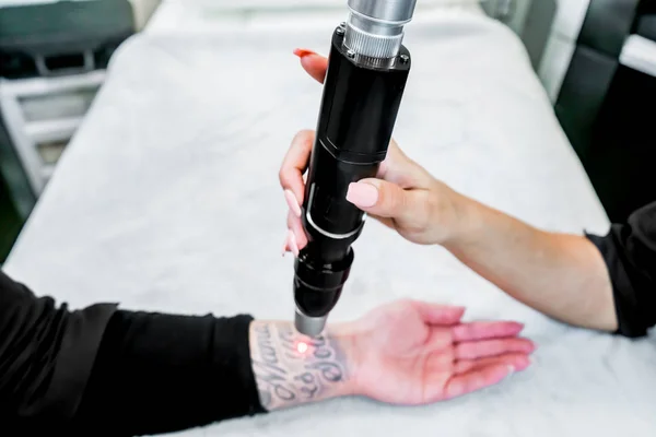 Bir hastanın kolunda büyük bir dövme Lazer dövme kaldırma, picosecond lazer teknolojisi kullanarak, bir güzellik ve tıbbi lazer kliniğinde. Teknisyen el parçasını tutuyor..