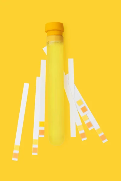 Biohacking Tła Moczu Probówce Test Taśmy Żółtym Tle Biotec — Zdjęcie stockowe