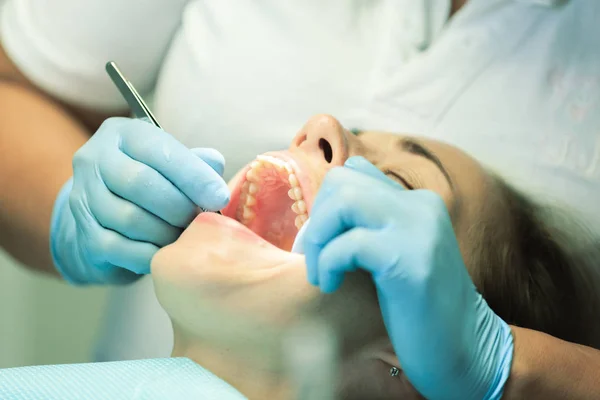 Close Young Girl Open Mouth Dentist Teeth Checkup Dentist Office — Stock Photo, Image