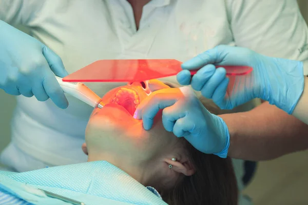 Dentist fixed and dry dental fillings with a light. Dentist\'s assistant holding an orange glass to protect the eyes of a patient. Close up.