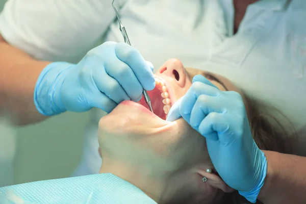 Close Young Woman Open Mouth Dentist Teeth Checkup Dentist Office — Stock Photo, Image