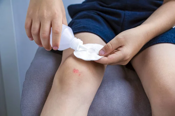 Niño Trata Herida Rodilla Con Almohadilla Algodón Peróxido Pierna Del —  Fotos de Stock