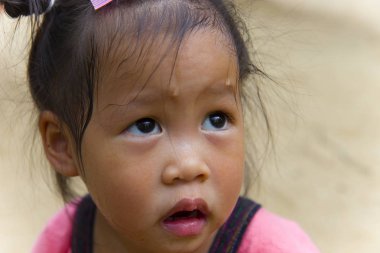 Toddler's Face yüzünde bir şey ve terli arıyor .