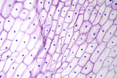 Soğan epidermiste hafif mikroskop altında. Mor renkli, büyük epidermal hücrelerin bir soğan, Allium cepa, tek bir katmanda. Her hücre duvar, zarı, sitoplazma, çekirdek ve büyük çarpıtma. 