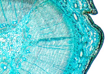 Çam olgun ahşap kesit. Işık mikroskobu slayt herdem yeşil bir kozalaklı cins Pinus microsection ile. Bitki Anatomisi. Biyoloji. Fotoğraf.