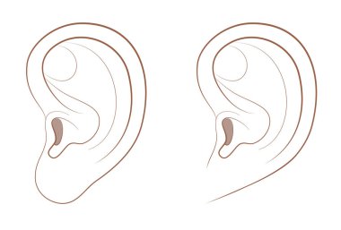 Free earlobe and attached earlobe in comparison. Different appearance of the human ear because of recessive gene frequency. Isolated comic vector illustration on white background. clipart