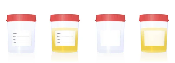 Specimen Cups Blank Labels Red Screw Caps Empty Filled Urine — Stock Vector