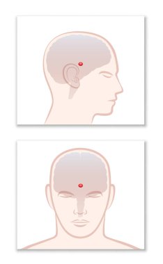 Pineal gland. Profile and frontal view with location in the human brain. Isolated vector illustration on white background. clipart